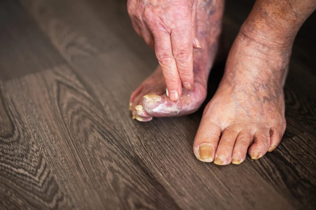 Cuidado de los pies en personas mayores: revisiones y consejos 1 El cuidado de los pies en mayores previene problemas y mejora la calidad de vida. Consejos prácticos y revisiones en nuestra clínica de Olite. Pide cita. - Cuidado de los pies en personas mayores: revisiones y consejos