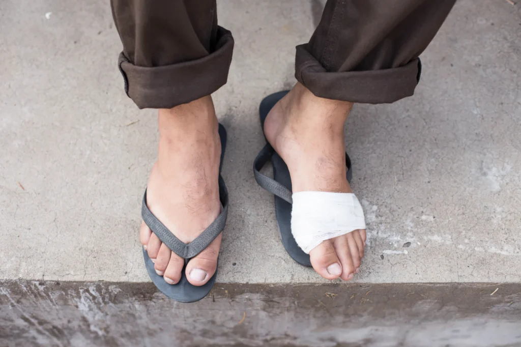 juanetes hallux valgus - Juanetes o hallux valgus: tratamiento sin cirugía con ortesis de silicona