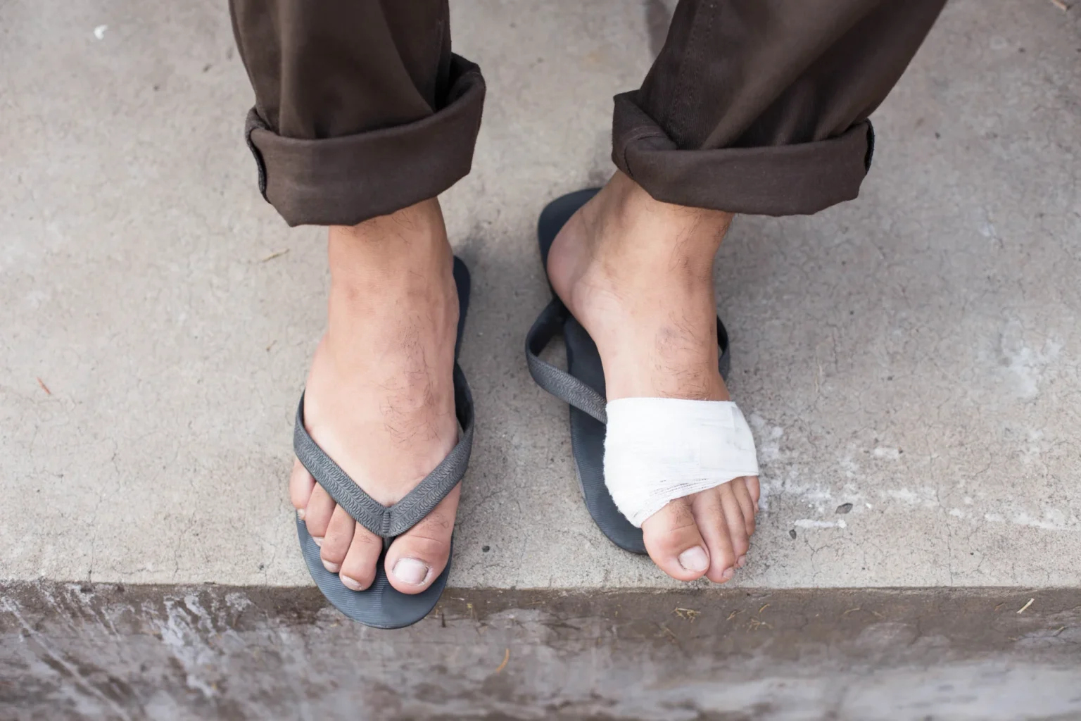 juanetes hallux valgus - Juanetes o hallux valgus: tratamiento sin cirugía con ortesis de silicona